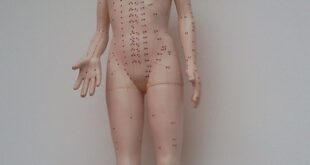 acupuncture