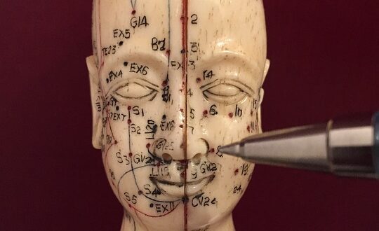 acupuncture