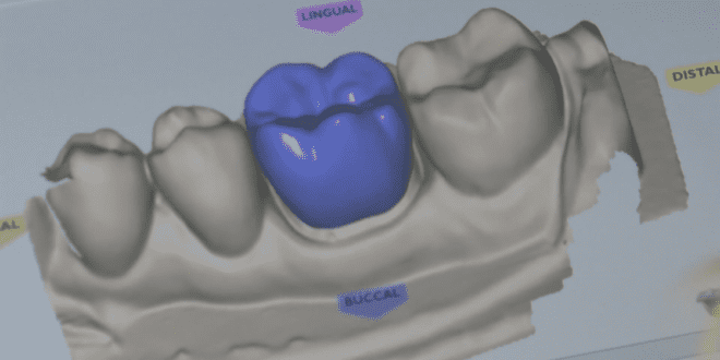 Examining KCU's dental tech advancements in brief.