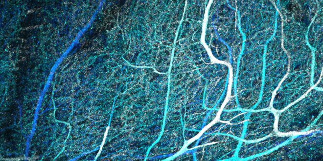 Surprising intricacy found in cerebellar connections.