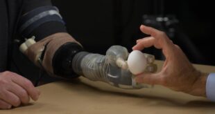 Prosthetic limb technology advances - feeling and control.