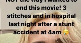 Rebel Wilson injured on set, needs stitches.